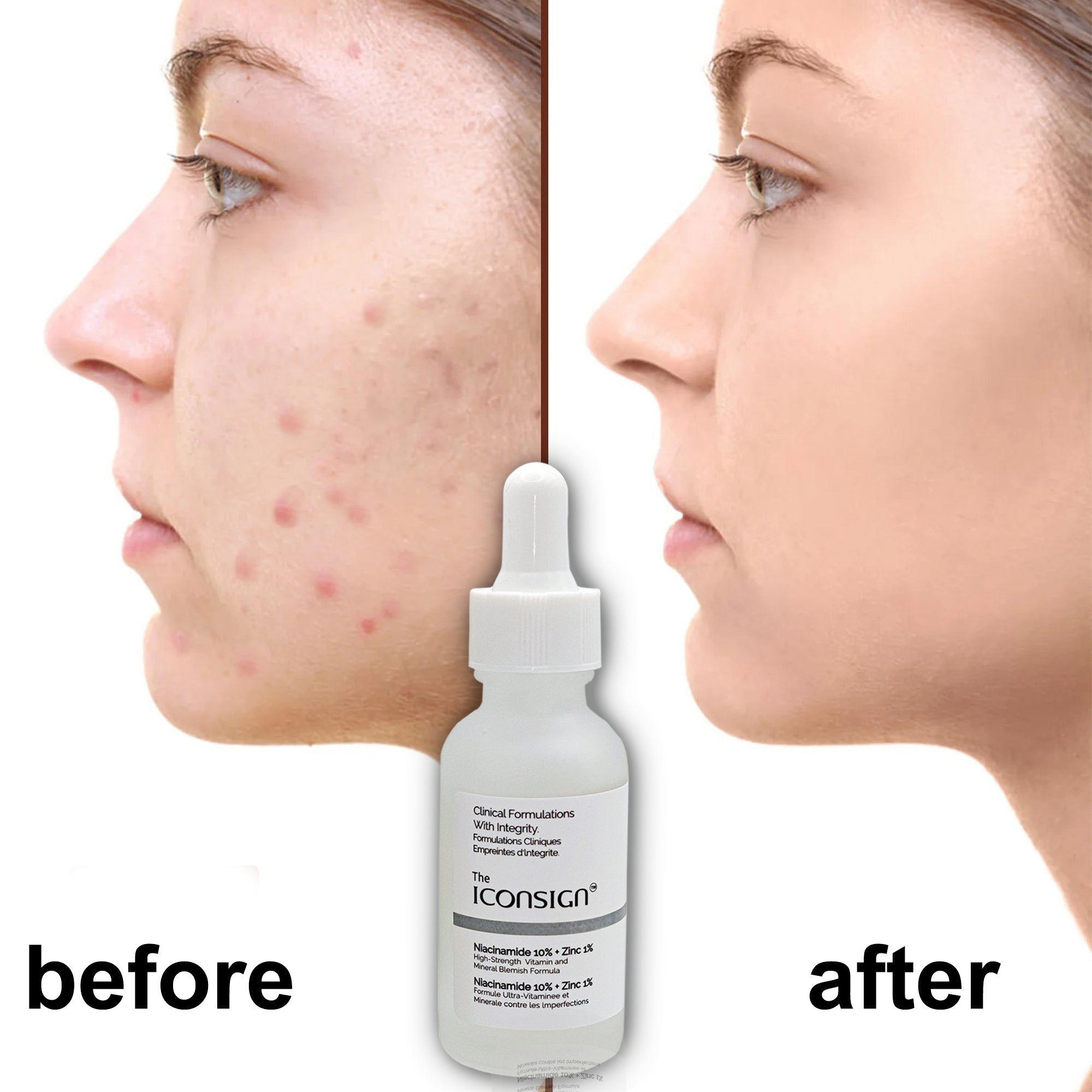 Woman applying a few drops of Iconsign Vitamin C Serum to a cleansed face